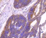 ID1 Antibody in Immunohistochemistry (Paraffin) (IHC (P))