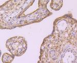 ID1 Antibody in Immunohistochemistry (Paraffin) (IHC (P))