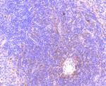 Phospho-MLKL (Ser345) Antibody in Immunohistochemistry (Paraffin) (IHC (P))