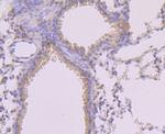 Phospho-MLKL (Ser345) Antibody in Immunohistochemistry (Paraffin) (IHC (P))