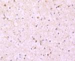 Ferritin Light Chain Antibody in Immunohistochemistry (Paraffin) (IHC (P))