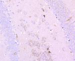 PDHB Antibody in Immunohistochemistry (Paraffin) (IHC (P))