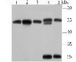 KPNA2 Antibody in Western Blot (WB)