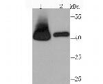 RRM2 Antibody in Western Blot (WB)