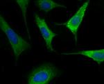 Nogo-B Antibody in Immunocytochemistry (ICC/IF)