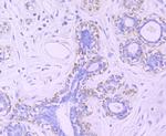 TFAM Antibody in Immunohistochemistry (Paraffin) (IHC (P))