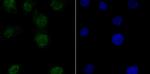 PFKFB3 Antibody in Immunocytochemistry (ICC/IF)