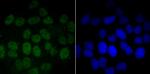 PFKFB3 Antibody in Immunocytochemistry (ICC/IF)