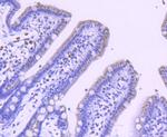 PFKFB3 Antibody in Immunohistochemistry (Paraffin) (IHC (P))