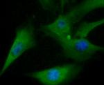 TXNIP Antibody in Immunocytochemistry (ICC/IF)