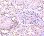 TXNIP Antibody in Immunohistochemistry (Paraffin) (IHC (P))