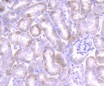 JAK1 Antibody in Immunohistochemistry (Paraffin) (IHC (P))