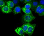 TFF1 Antibody in Immunocytochemistry (ICC/IF)