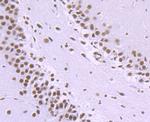 NRF1 Antibody in Immunohistochemistry (Paraffin) (IHC (P))