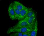 GCLM Antibody in Immunocytochemistry (ICC/IF)