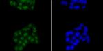 SATB2 Antibody in Immunocytochemistry (ICC/IF)