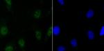 SATB2 Antibody in Immunocytochemistry (ICC/IF)