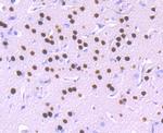 SATB2 Antibody in Immunohistochemistry (Paraffin) (IHC (P))