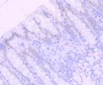 SATB2 Antibody in Immunohistochemistry (Paraffin) (IHC (P))