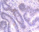 SATB2 Antibody in Immunohistochemistry (Paraffin) (IHC (P))