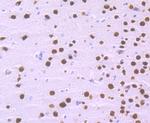 SATB2 Antibody in Immunohistochemistry (Paraffin) (IHC (P))