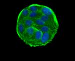 RAD51 Antibody in Immunocytochemistry (ICC/IF)