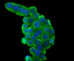 RAD51 Antibody in Immunocytochemistry (ICC/IF)