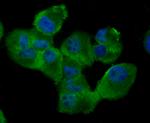 RAD51 Antibody in Immunocytochemistry (ICC/IF)