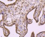 RAD51 Antibody in Immunohistochemistry (Paraffin) (IHC (P))