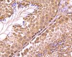 RAD51 Antibody in Immunohistochemistry (Paraffin) (IHC (P))