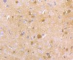 HPRT1 Antibody in Immunohistochemistry (Paraffin) (IHC (P))