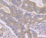 HPRT1 Antibody in Immunohistochemistry (Paraffin) (IHC (P))