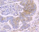 IFITM3 Antibody in Immunohistochemistry (Paraffin) (IHC (P))