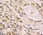 Histone Macro-H2A.1 Antibody in Immunohistochemistry (Paraffin) (IHC (P))