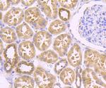 Zyxin Antibody in Immunohistochemistry (Paraffin) (IHC (P))