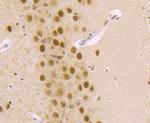 DDB1 Antibody in Immunohistochemistry (Paraffin) (IHC (P))