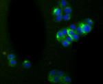 alpha Internexin Antibody in Immunocytochemistry (ICC/IF)