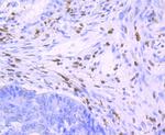 SAMHD1 Antibody in Immunohistochemistry (Paraffin) (IHC (P))