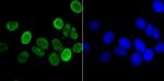 H3K14ac Antibody in Immunocytochemistry (ICC/IF)