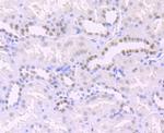 H3K14ac Antibody in Immunohistochemistry (Paraffin) (IHC (P))