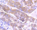 ATG3 Antibody in Immunohistochemistry (Paraffin) (IHC (P))