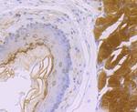 SDHB Antibody in Immunohistochemistry (Paraffin) (IHC (P))