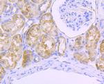 SDHB Antibody in Immunohistochemistry (Paraffin) (IHC (P))