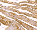 SDHB Antibody in Immunohistochemistry (Paraffin) (IHC (P))