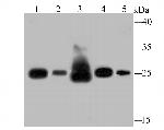 SDHB Antibody in Western Blot (WB)