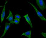 LOX Antibody in Immunocytochemistry (ICC/IF)