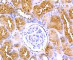 LOX Antibody in Immunohistochemistry (Paraffin) (IHC (P))