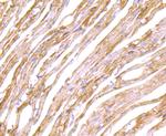 LOX Antibody in Immunohistochemistry (Paraffin) (IHC (P))