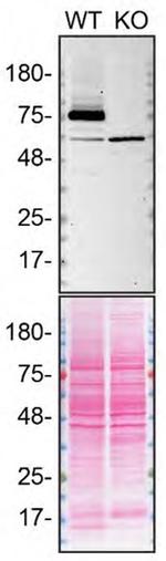 TGM2 Antibody