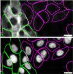 TGM2 Antibody